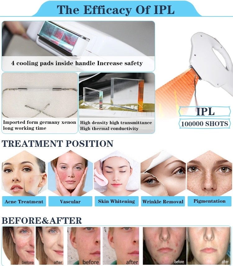 IPL laser hair removal machine nubway laser home hair removal machine ipl beauty salon equipment