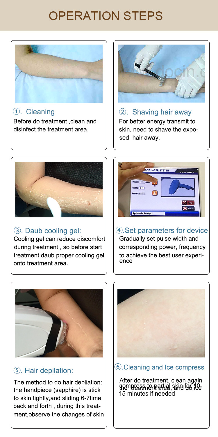 Alexandrite Laser Hair Removal Machine For All Hair Colors