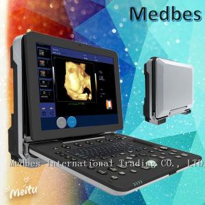 China Medical Diagnostic Ultrasounic Machine Hospital Fetal doppler Ultrasound Scanner wholesale