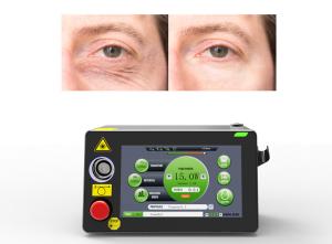 China 30W Medical Laser Equipment Blepharoplasty Treatment 980nm wholesale