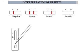 One Step Rapid Colloidal Gold Test For IgM Antibody To Mumps Virus
