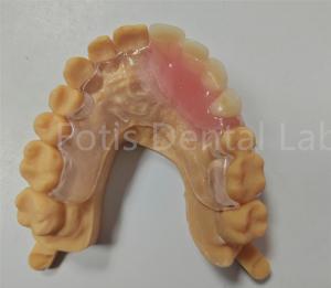 China Hypoallergenic Comfort Fit Flexible Valplast Partial TCS Dental Appliance wholesale
