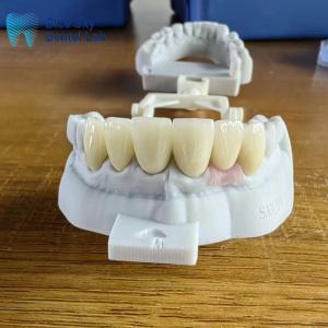 China Highly Translucent Layered Zirconia Crowns Natural With Implant Crown wholesale