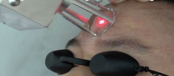 RF tube Fractional CO2 Laser Vaginal Tightening And Rejuvenation Machine