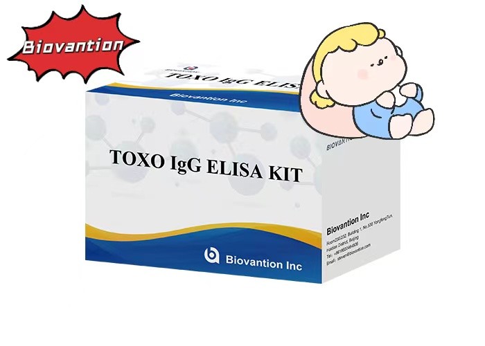 Torch High Sensitivity TOXO IgG ELISA Test Kit Hospital Test Pregnancy Check