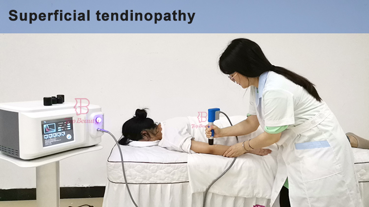 Extracorporeal Shock Wave Therapy Machine For Erectile Dysfunction Shockwave Acoustic Device