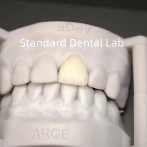 China Digital CAD CAM Dental Lab Crowns Translucent Layered Zirconia Crown wholesale