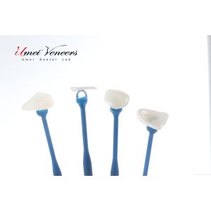 Natural Whitening Hollywood Veneers