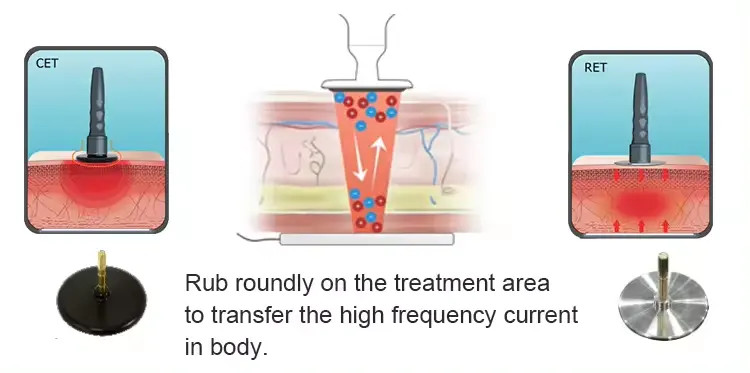 448khz Indiba Radiofrequency Tecar Therapy Skin Tightening Machine Rf Fat Loss Machine