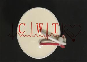 China XL+ Defibrillator Machine Parts Dia5cm Defibrillator Capacitor wholesale