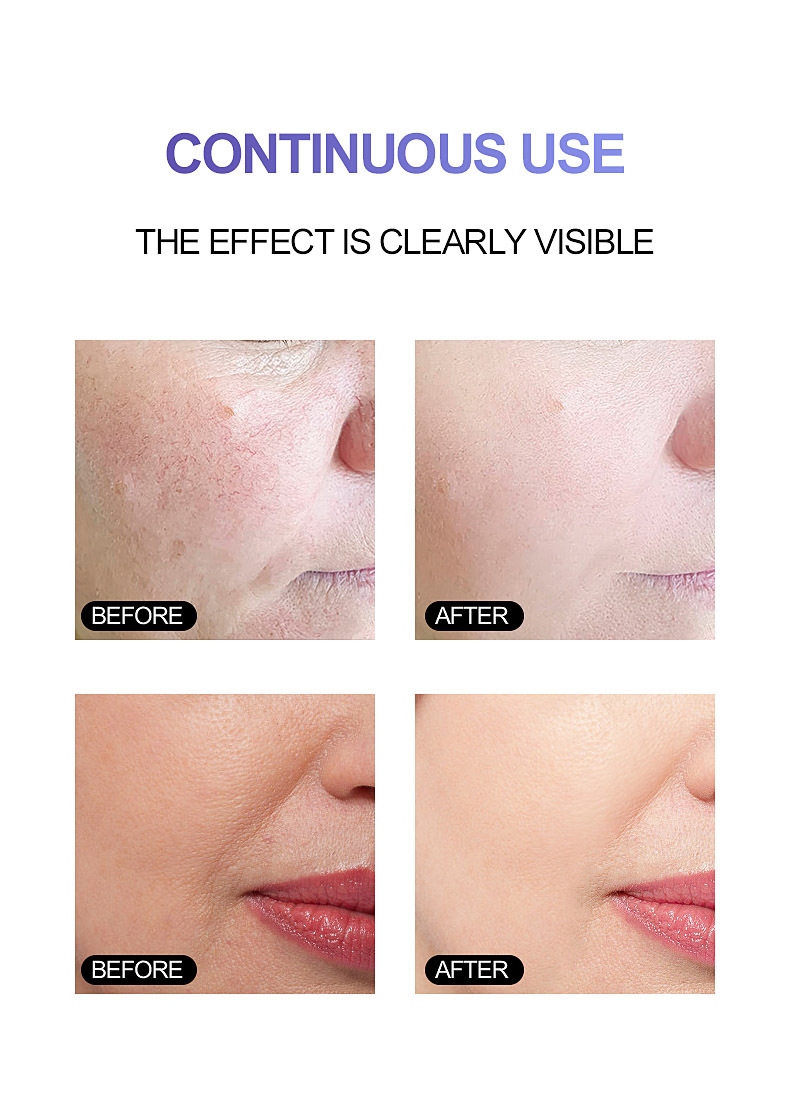 Hot Sale Anti Aging 4 in 1 Face Vitamin c Serum Private Label for Dark Spots Bulk