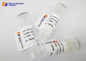 China Mouse Anti ENO2 Custom Monoclonal Antibody with NSE Fusion Protein wholesale