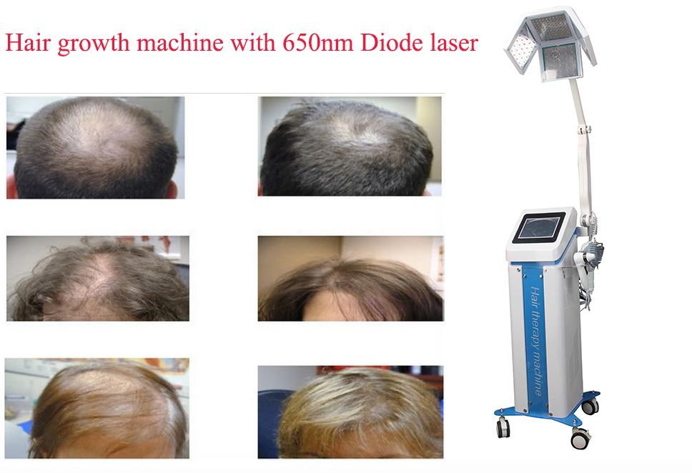 Beauty Hair Laser Regrowth Machine Diode Photodynamic Therapy Device 650nm