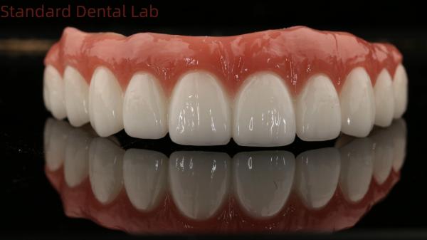 High Quality Dental zirconia crown and All On Four Six Implant Full Arch / China