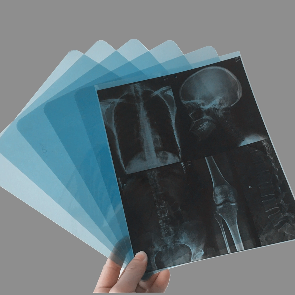 210 Microns X-ray Film Medical Inkjet &amp; Laser for CT Dr Mr