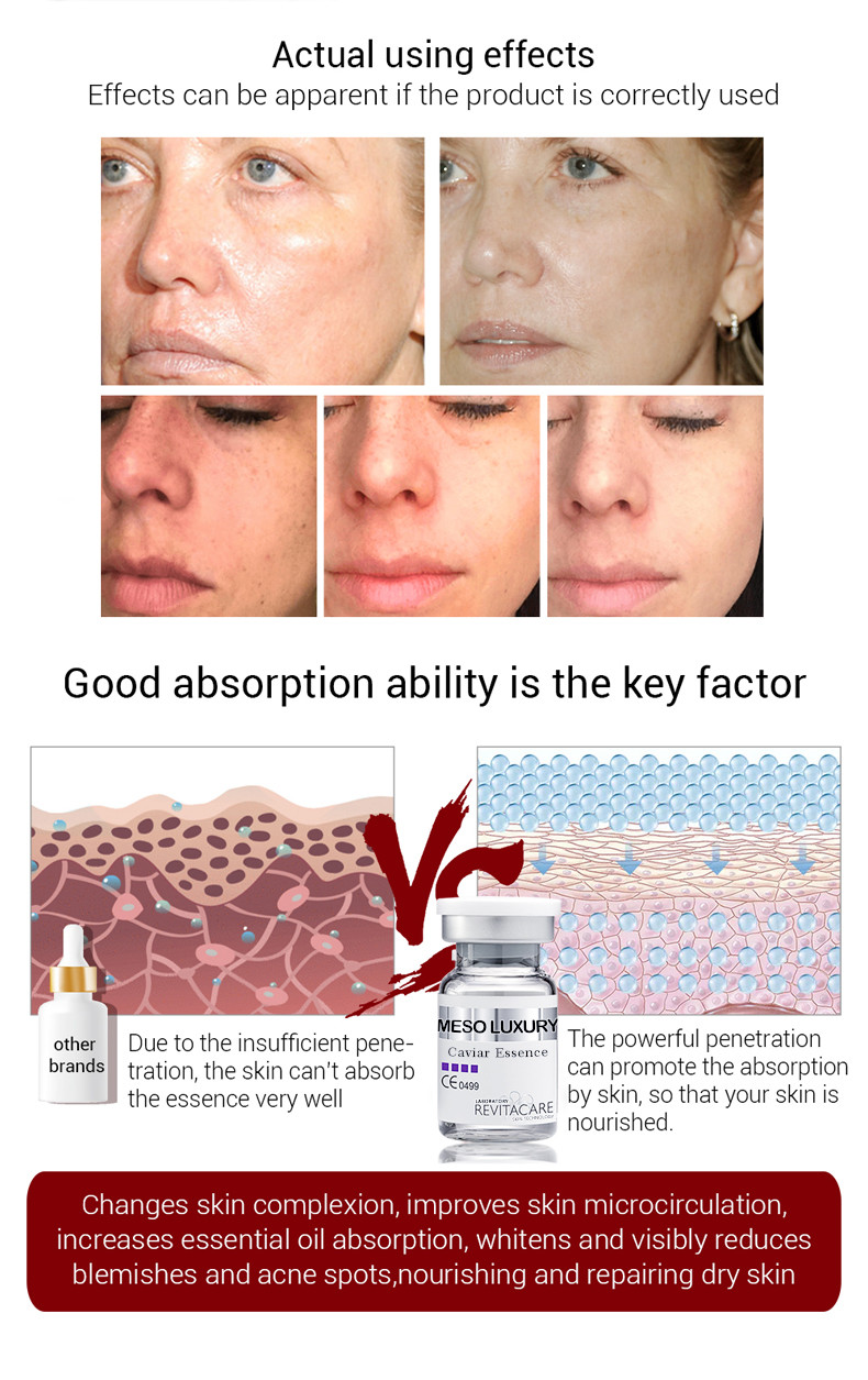 derma Meso Serum Microneedling 10ml Brightening Caviar Anti Aging Serum