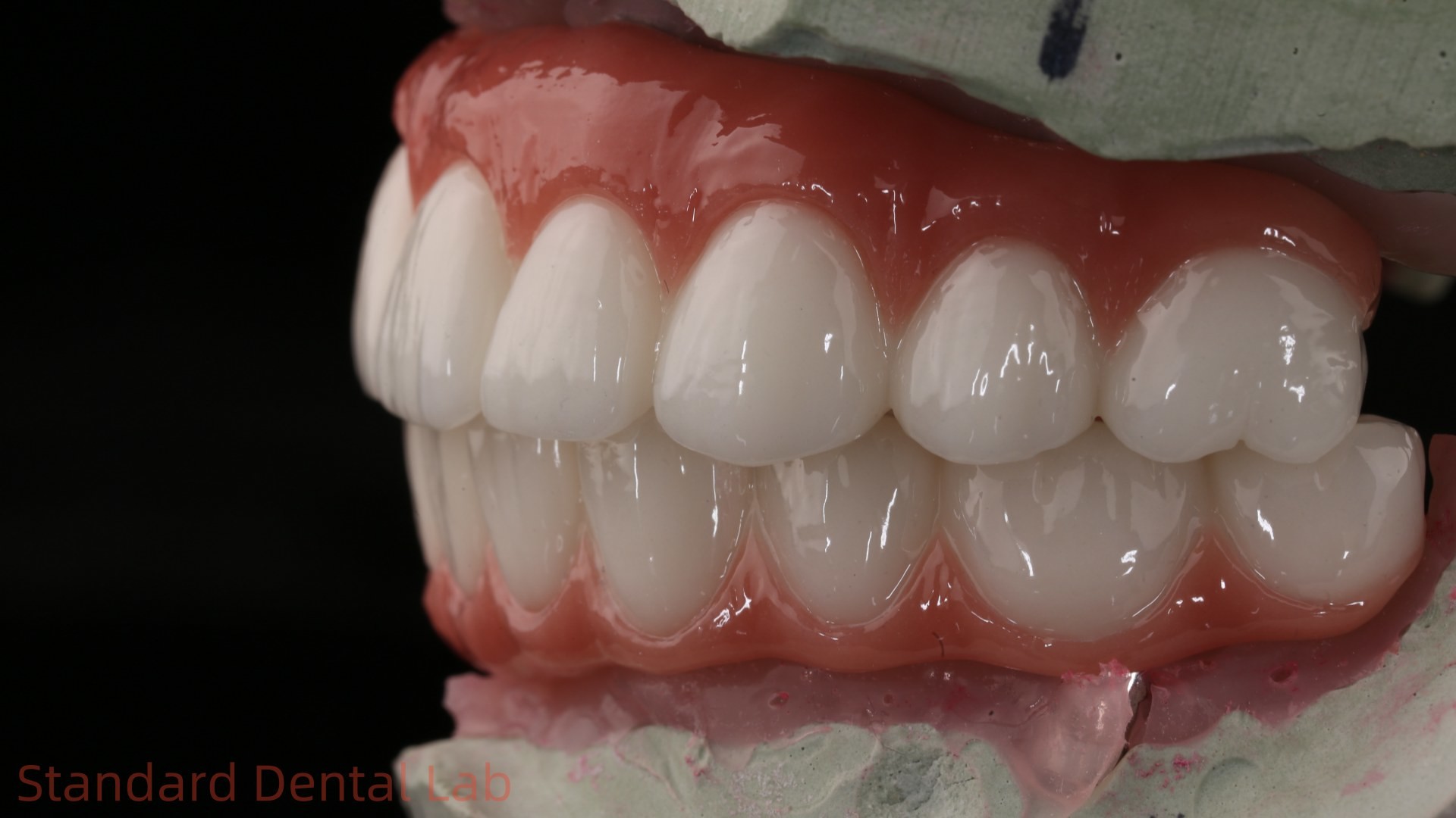 High Quality Dental zirconia crown and All On Four Six Implant Full Arch / China dental lab Manufacturer
