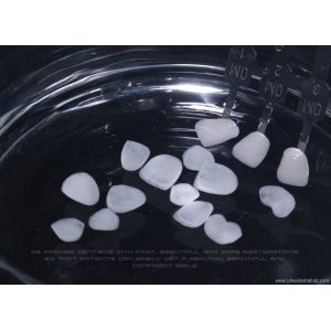 Zirconia Ceramic Veneer Natural White