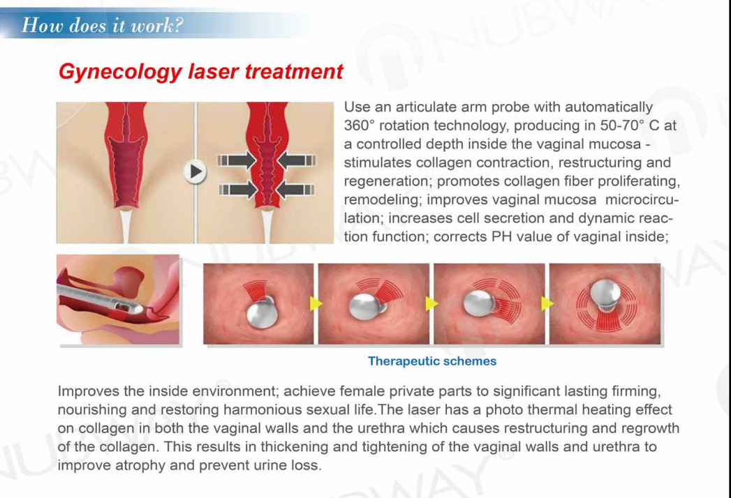Fractional co2 laser for skin renewing CO2 fractional laser machine with newest technolog