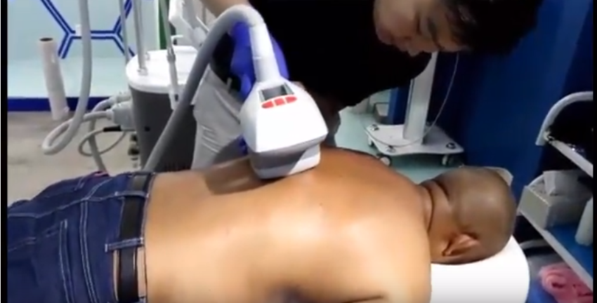 FDA approved ultrasound cavitation Radio frequency lpg endermologie machine price
