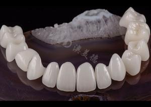 China Translucent Dental Tooth Solid Zirconia Crown Natural Aesthetics Chipping Resistance wholesale