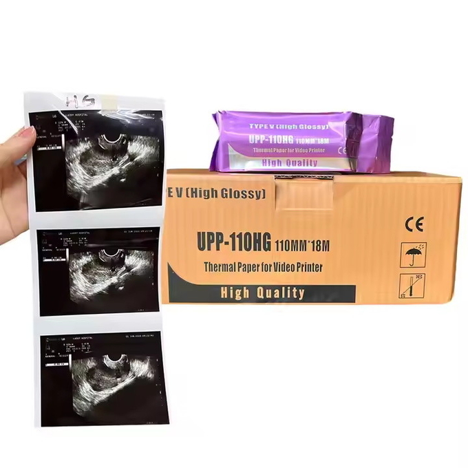 Thermal Print Film for Ultrasound Paper: Eco-Friendly Recyclable Options in 75um & 95um - Ideal for Packaging Labels & Bulk Rolls