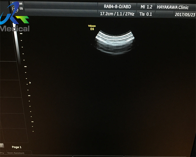 GE RAB4-8-D Wideband Convex Array Ultrasound Probe For gynecological