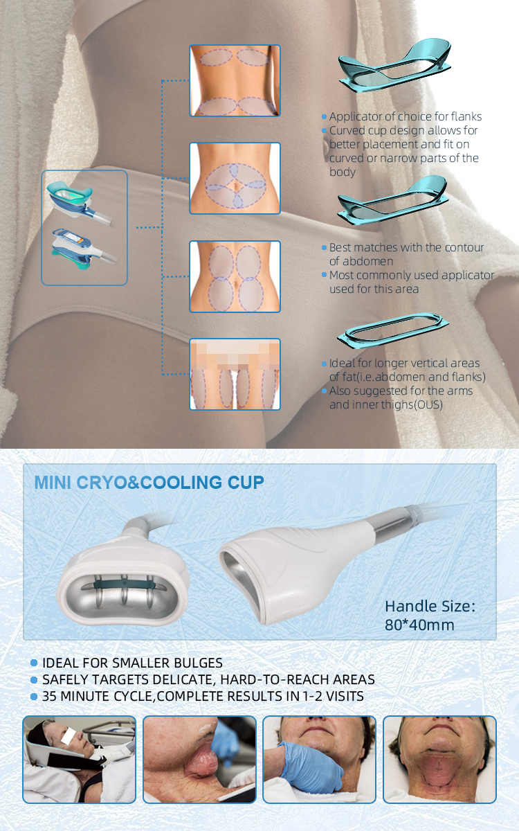 5 Handles Cryolipolysis Slimming Machine Body RF With LCD Display