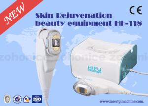 China Home High Intensity Focused sound Machine and Female Face Lifting Beauty Device wholesale