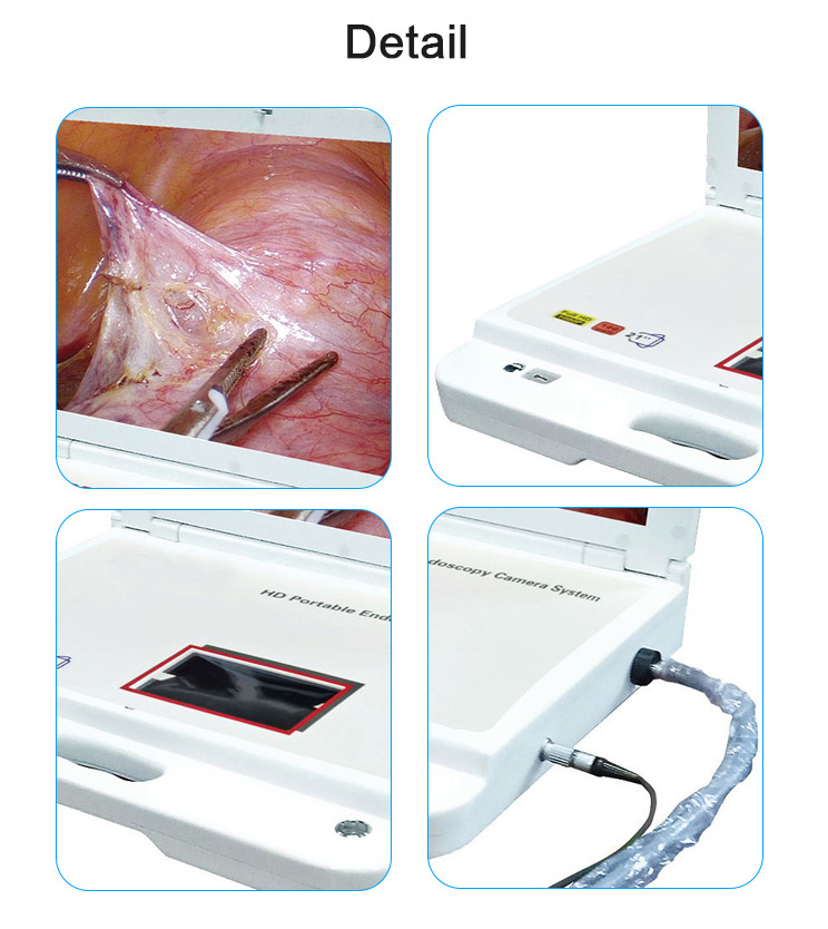 Hospital Machine Digital Video Portable Endoscope System