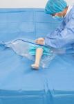Medical Disposables Operational Knee Surgical Drape Arthroscopy Sterile Pack