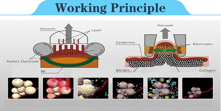 working-principle.jpg