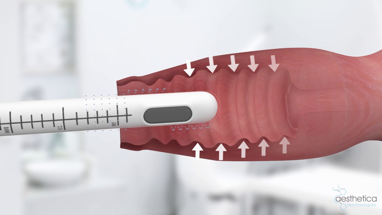 4D Hifu Tighten Skin Machine Ultra 4D High Intensity Focused Ultrasound Skin Tightening Machine HIFU Device Skin Lift
