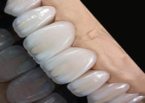 China Translucency Stain Resistant Ceramic Crown Bridge Precise Fit for Natural looking Smile wholesale