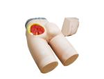 Intramuscular Injection Training Artificial Buttocks