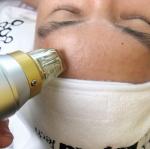 Touch Screen Microneedling Fractional RF Skin Rejuvenation 0.2MM Needle