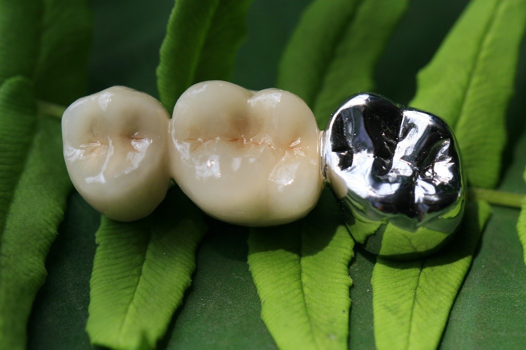 Dental Lab Product CAD CAM PFM Crown porcelain fused to metal