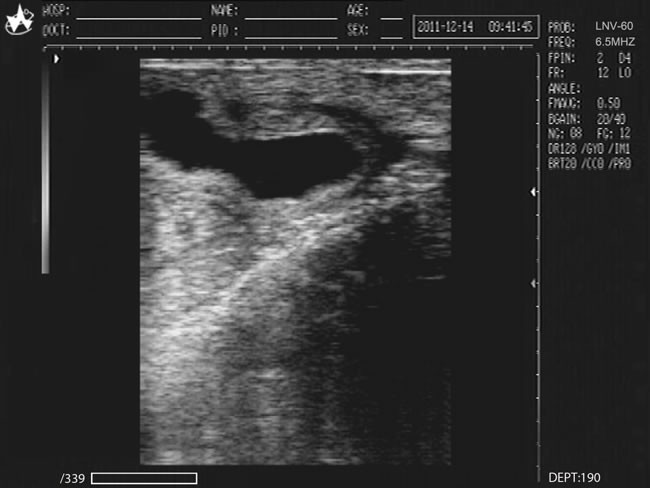 Medical Veterinary Equipment 10.4 Inches Screen Portable Ultrasound Scanner