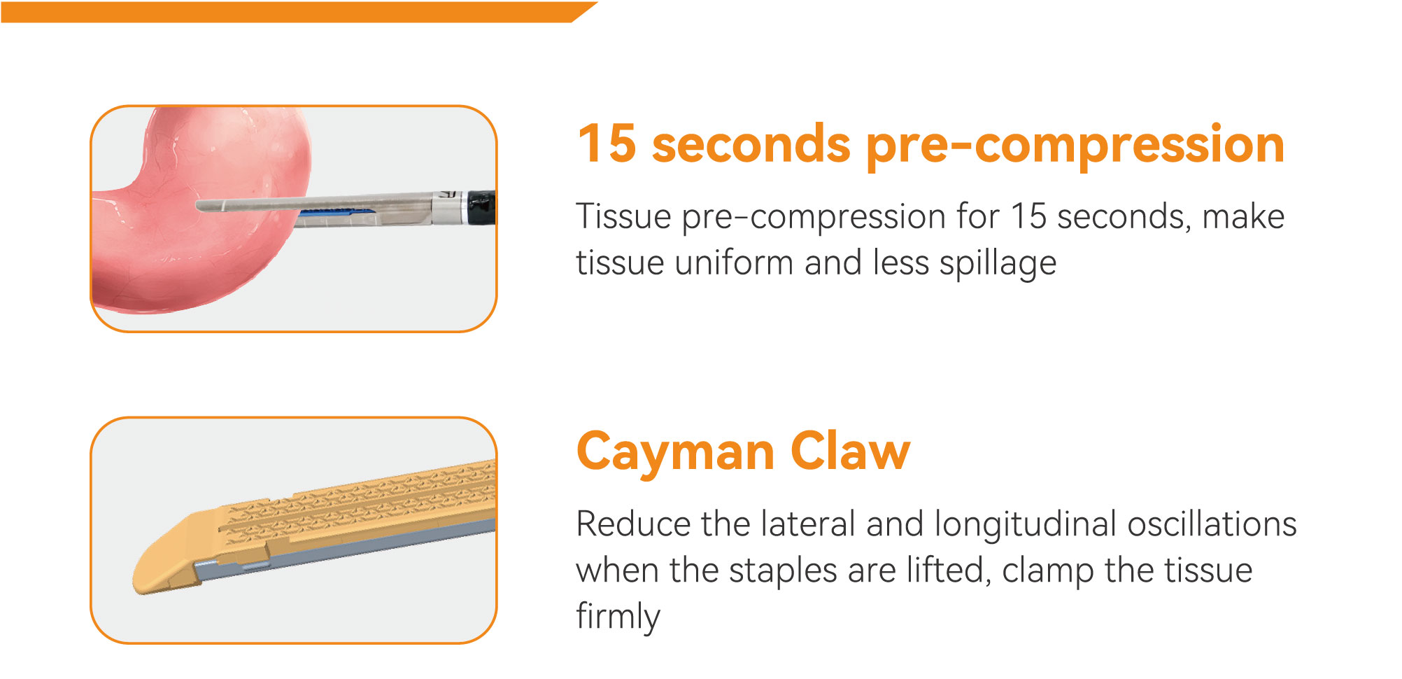 Linear Stapler Surgery - Powered Endoscopic Stapler