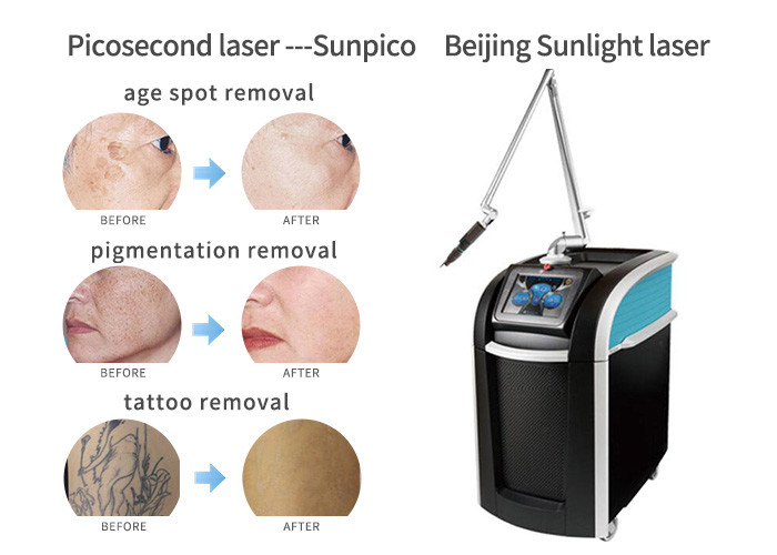 Pigments Tattoo Removal Machine , Fast Effective Laser Tattoo Removal Equipment
