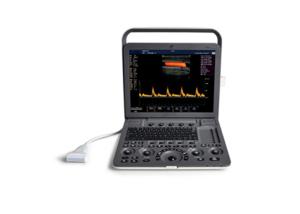 China Color Doppler Portable Ultrasound Scanner For Abdomen / Obstetrics CE Certified wholesale