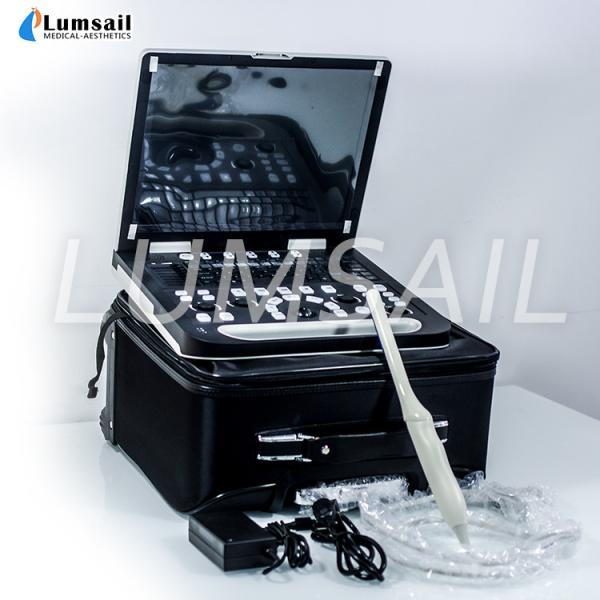15 Inch Full Digital Laptop Ultrasound Scanner Doppler Ultrasonic Diagnostic