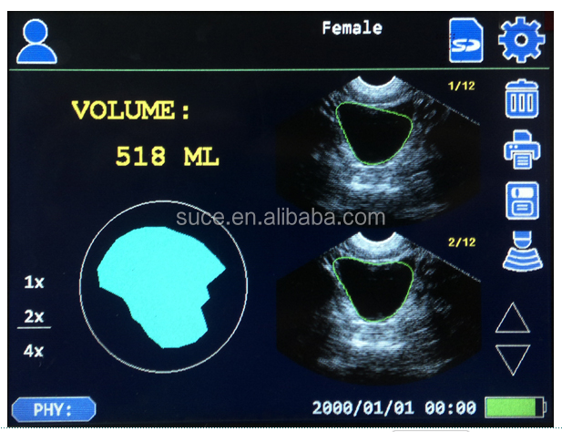 CareScan-1cheap ultrasound Portable bladder scanner