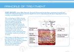 Newest hifu technology / HIFUSLIM !!! NUBWAY Vacuum Cavitation System hifu body