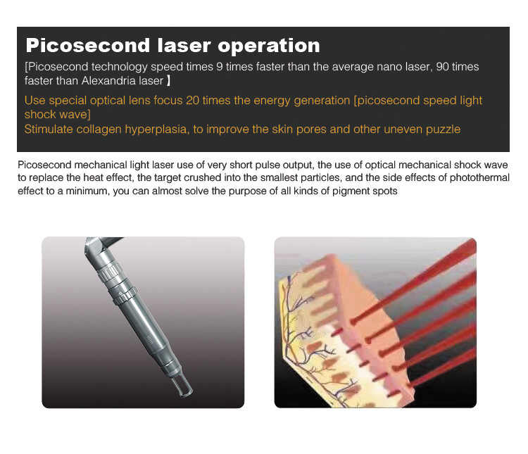 Q switch 755nm 1064nm 532nm Portable Pico laser for all colour tattoo removal