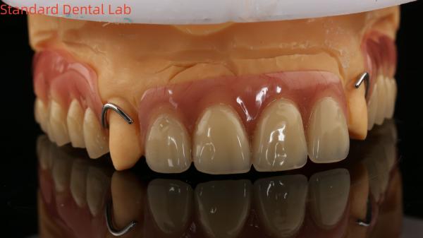 Heat Cured Ivoclar Partial Acrylic Denture Dental Lab High Accuracy with 3D