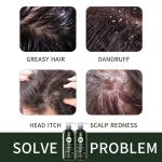 Private Label Tea Tree Shampoo Anti-Dandruff Nourishing Natural Herbal Sulfate