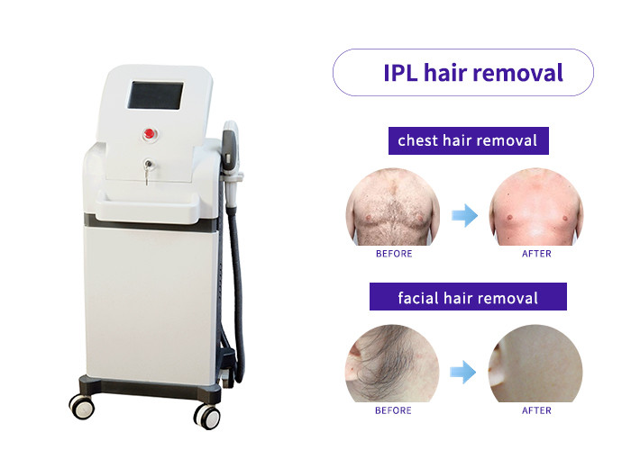 Powerful 3000W E Light Ipl Machine Strong Pulse Light For Hair Removal / Skin Rejuvenation