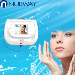 China CE approval qualified RBS 30MHz high frequency machine for spider vein removal wholesale