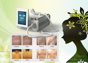 China 800-810nm wavelength Big spot size 12mm*20mm beautiful 808 diode hair removal machine wholesale